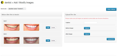 before-after plugins